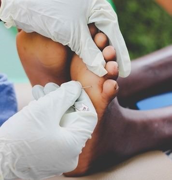 gloved hands treating bare feet
